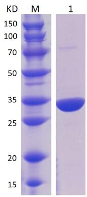 12% SDS-PAGE analysis profiles of purified MCR_RS08435-20-308 (CBB stained).